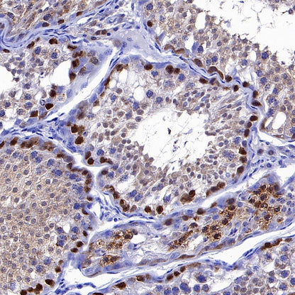Bovine RHOXF1 Recombinant Rabbit mAb (S-1764-118)