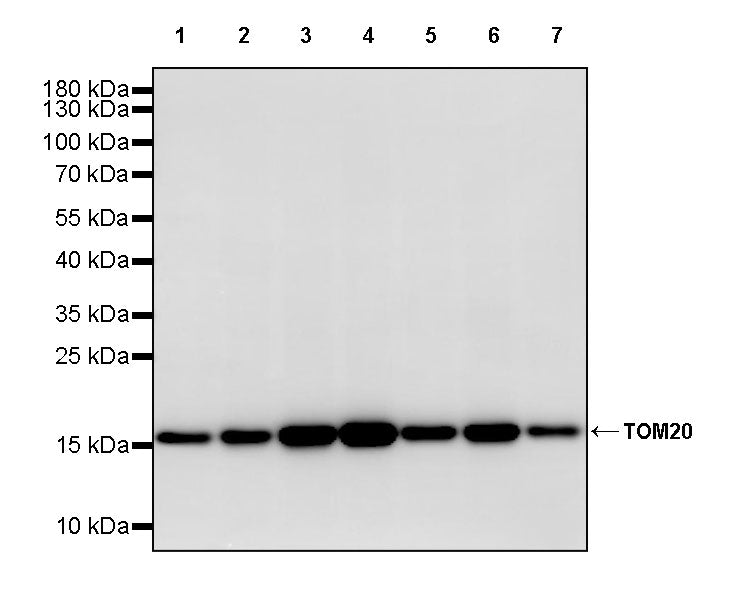TOM20 Recombinant Rabbit mAb (S-M0015)