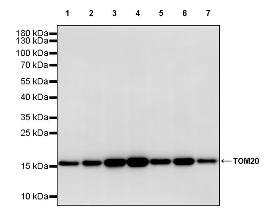 TOM20 Recombinant Rabbit mAb (S-M0015)