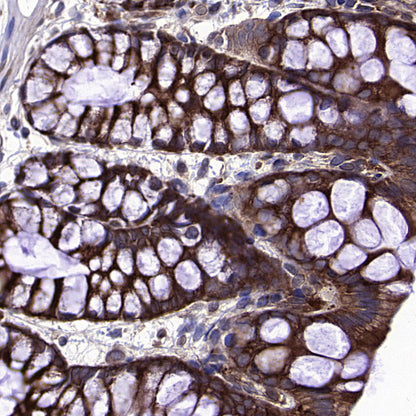HSP90 alpha/beta Recombinant Mouse mAb (S-5282)