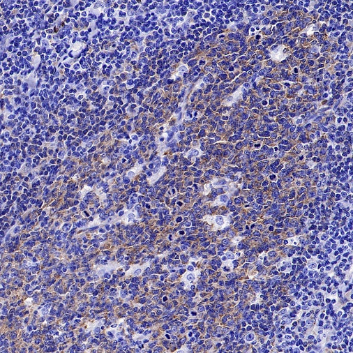 FAK Recombinant Rabbit mAb (S-1180-10)