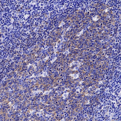 FAK Recombinant Rabbit mAb (S-1180-10)