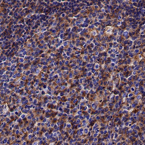 HLA-A Rabbit Polyclonal Antibody