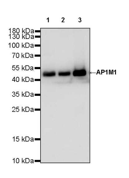 AP1M1 Recombinant Rabbit mAb (S-4593-28)
