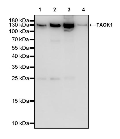 TAOK1 Recombinant Rabbit mAb (S-3673-80)