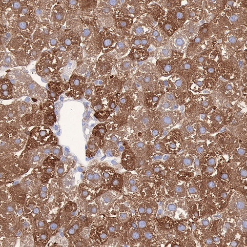 FASN Recombinant Rabbit mAb (S-682-32)