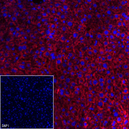 AMACR/p504s Recombinant Rabbit mAb (Alexa Fluor® 555 Conjugate) (SDT-401-29)