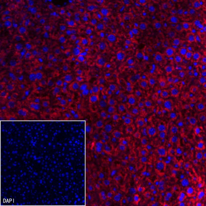AMACR/p504s Recombinant Rabbit mAb (Alexa Fluor® 555 Conjugate) (SDT-401-29)