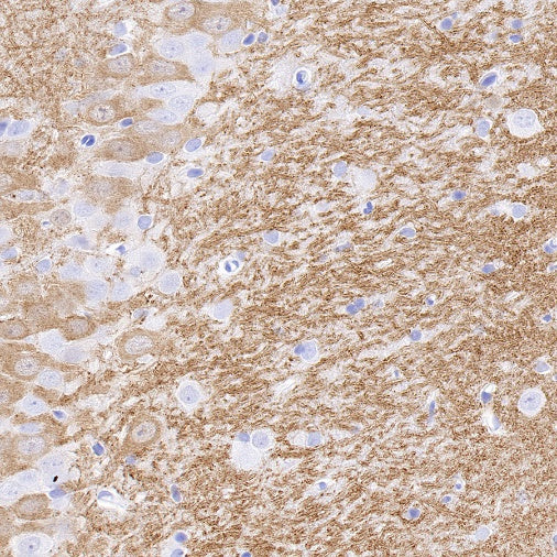 Sarcomeric Alpha Actinin Recombinant Rabbit mAb (S-1652-40)