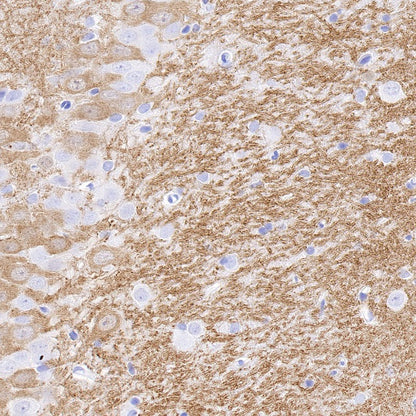 Sarcomeric Alpha Actinin Recombinant Rabbit mAb (S-1652-40)