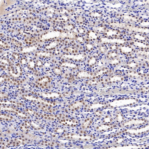 DNA Ligase IV/LIG4 Recombinant Rabbit mAb (S-2237-64)