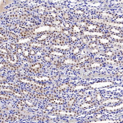 DNA Ligase IV/LIG4 Recombinant Rabbit mAb (S-2237-64)
