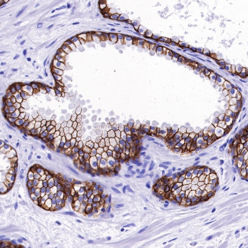 TACSTD2/TROP2 Recombinant Rabbit mAb (S-R237)