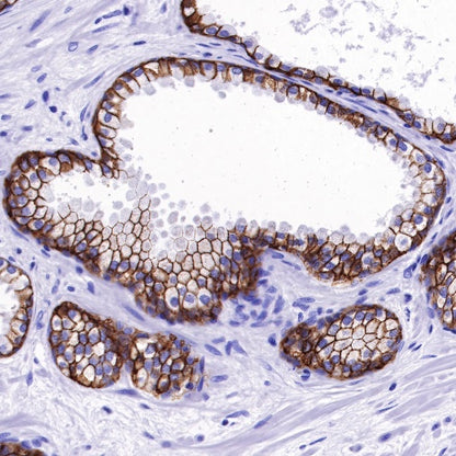TACSTD2/TROP2 Recombinant Rabbit mAb (S-R237)