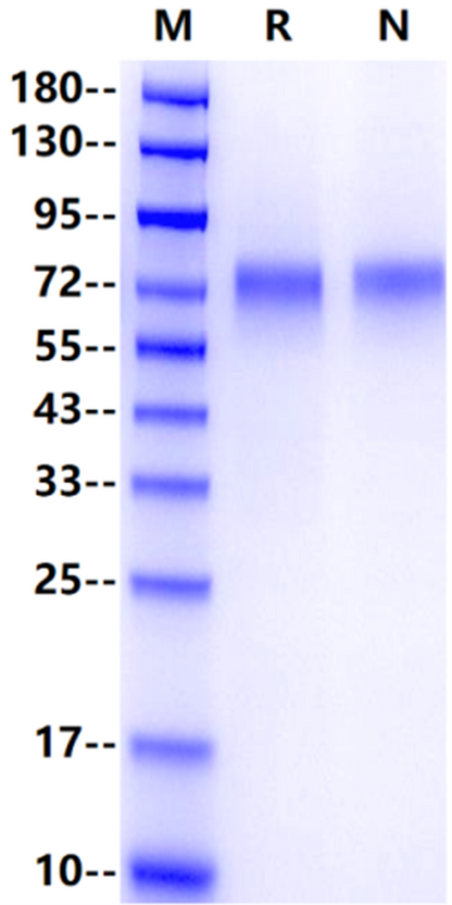 CD39/ENTPD1 His Tag Protein, Human