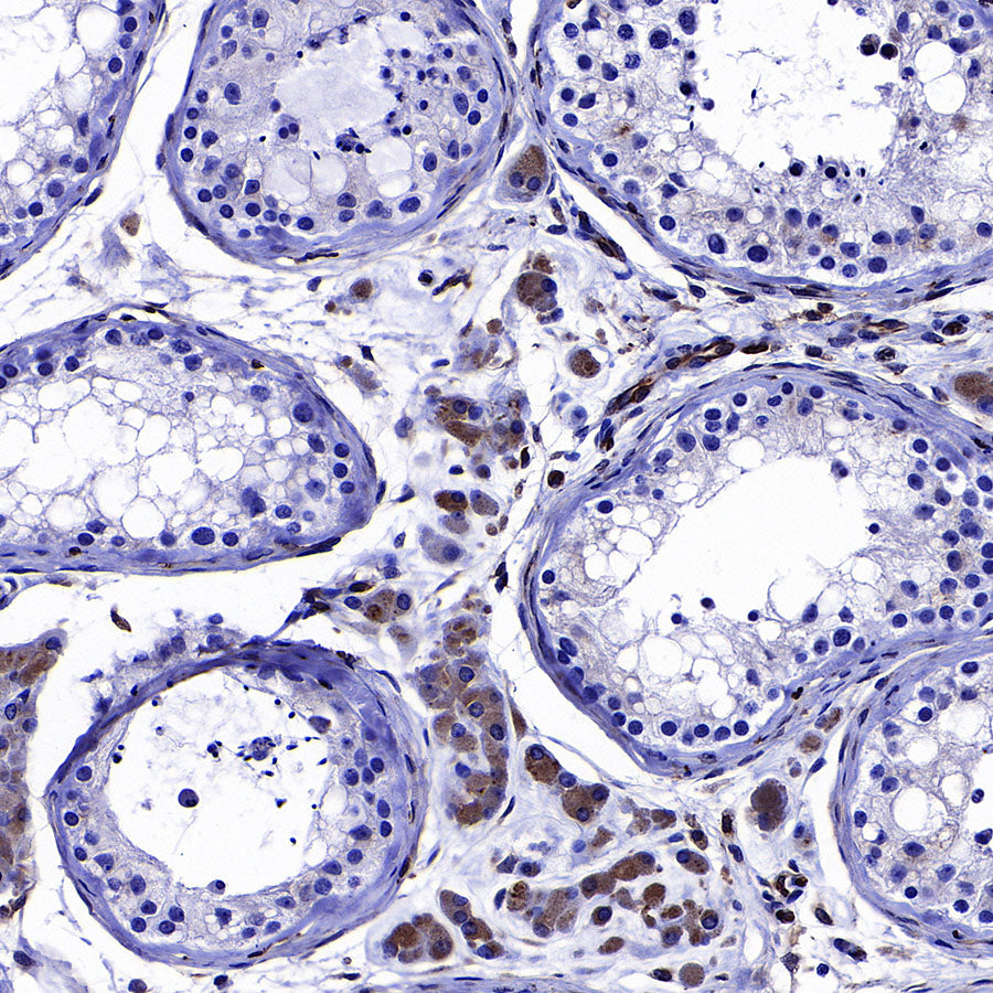 LPCAT2 Recombinant Rabbit mAb (S-4239-18)