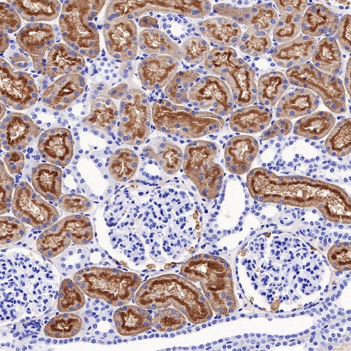 DPEP1 Recombinant Rabbit mAb (S-R293)