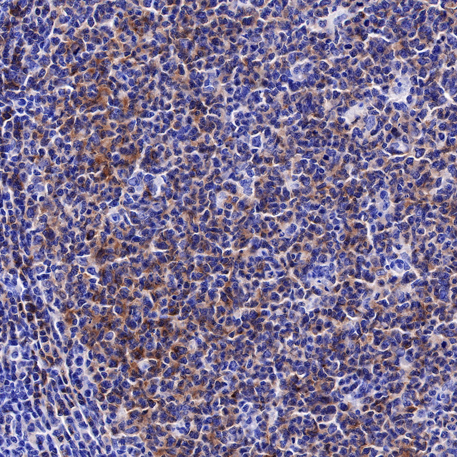 CD22 Recombinant Rabbit mAb (SDT-R113)