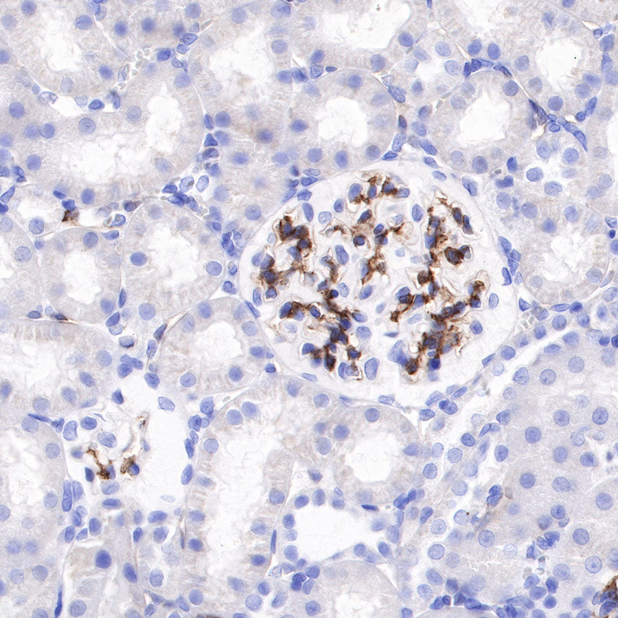 CD146 Recombinant Rabbit mAb (SDT-348-6)
