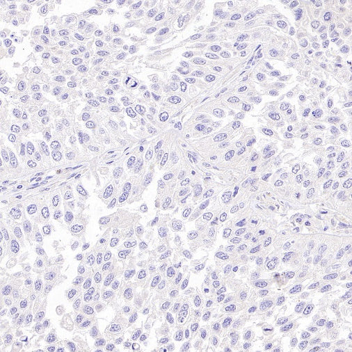 SS18-SSX Recombinant Rabbit mAb (SDT-4202)