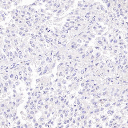 SS18-SSX Recombinant Rabbit mAb (SDT-4202)