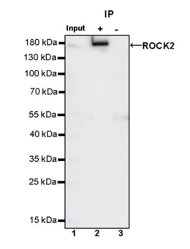 ROCK2 Rabbit Polyclonal Antibody