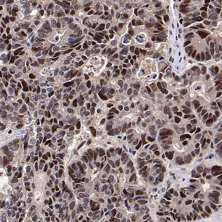PCNA Recombinant Mouse mAb (S-5477)