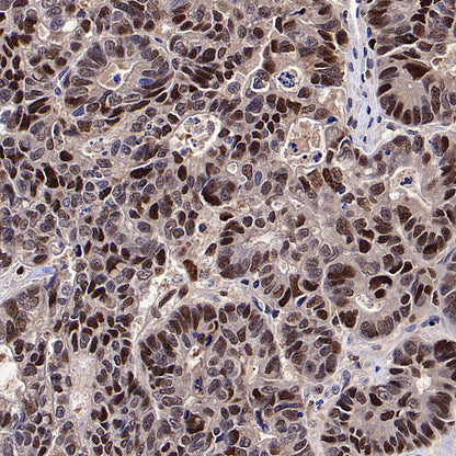 PCNA Recombinant Mouse mAb (S-5477)