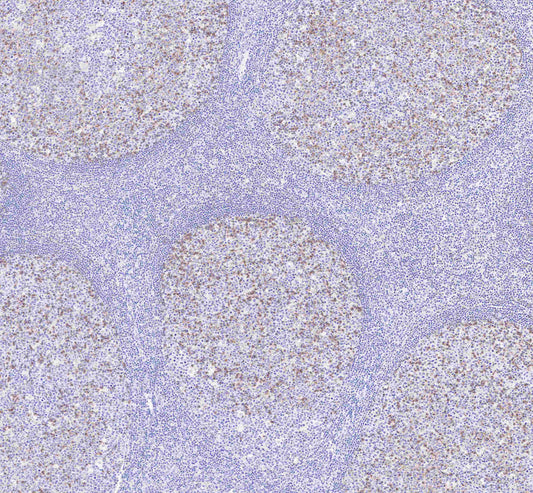 PD-1 Recombinant Rabbit mAb (SDT-035-25)