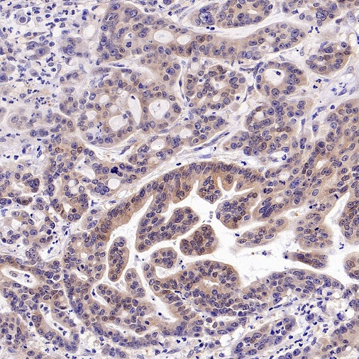 UBE2F Recombinant Rabbit mAb (S-2672-26)