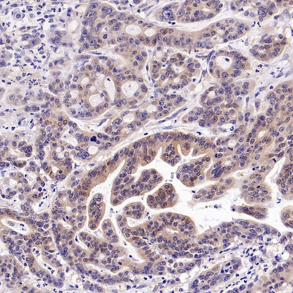 UBE2F Recombinant Rabbit mAb (S-2672-26)