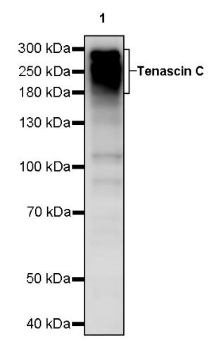 Tenascin C Recombinant Rabbit mAb (S-775-274)