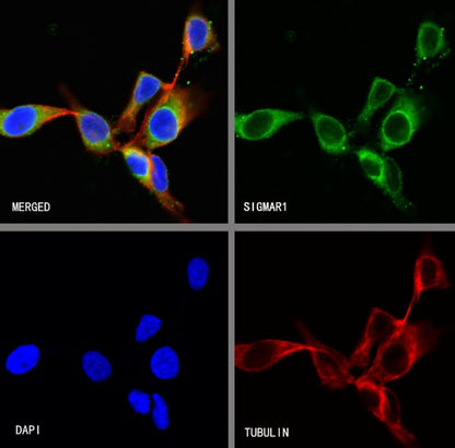 SIGMAR1 Recombinant Rabbit mAb (S-2079-270)