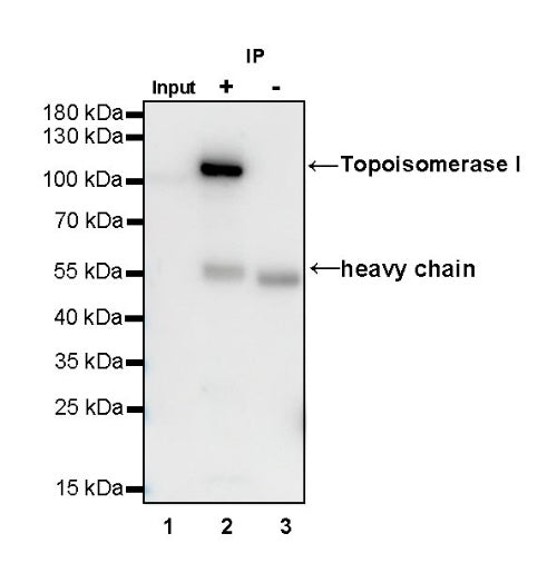S-RMab®Topoisomerase I Recombinant Rabbit mAb (S-R209)
