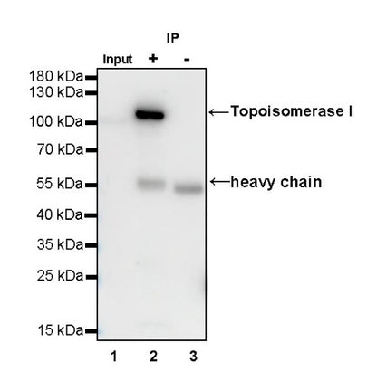 S-RMab®Topoisomerase I Recombinant Rabbit mAb (S-R209)