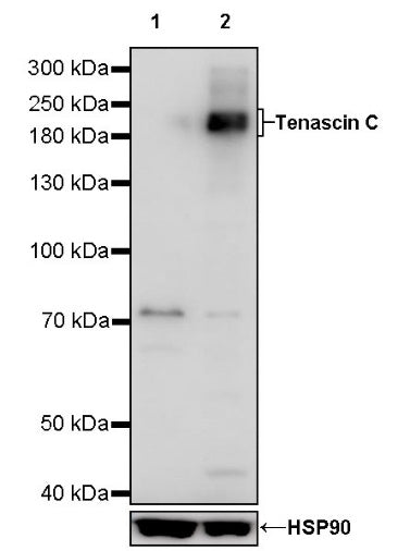 Tenascin C Recombinant Rabbit mAb (S-775-274)