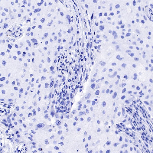 GLP-1 (active) Recombinant Rabbit mAb (S-R280)