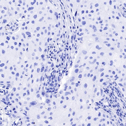 GLP-1 (active) Recombinant Rabbit mAb (S-R280)