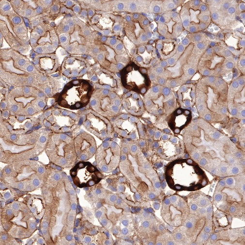 Non-muscle Myosin IIB/MYH10 Recombinant Rabbit mAb (S-299-3)