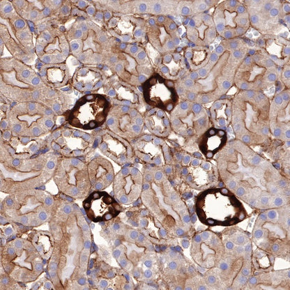 Non-muscle Myosin IIB/MYH10 Recombinant Rabbit mAb (S-299-3)