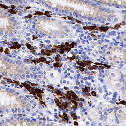 CXCR3 Recombinant Rabbit mAb (S-377-8)