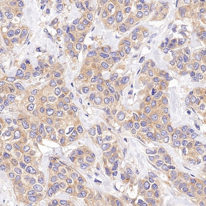 BRAF Recombinant Rabbit mAb (S-1328-60)