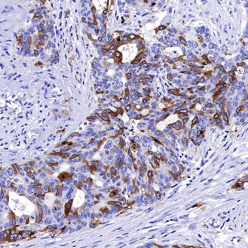 TACC3 Recombinant Rabbit mAb (S-3048-50)