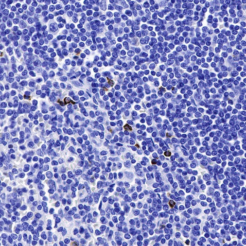 Granzyme B Recombinant Rabbit mAb (S-357-54)