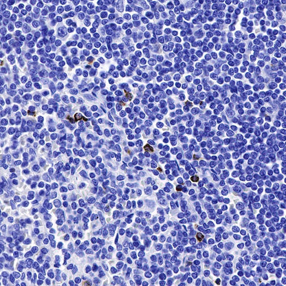 Granzyme B Recombinant Rabbit mAb (S-357-54)