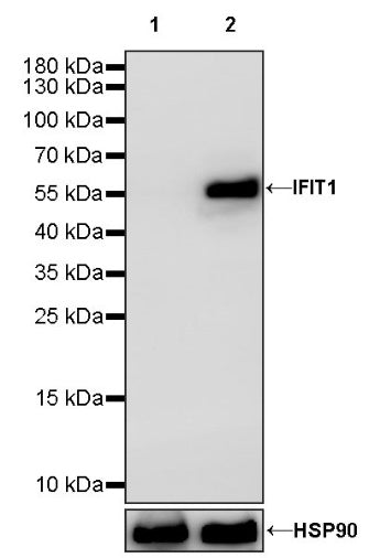 IFIT1 Recombinant Rabbit mAb (S-962-58)