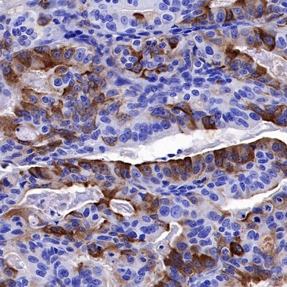 NGAL Recombinant Rabbit mAb (S-473-22)