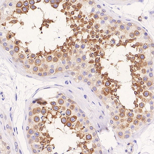 FXR1 Rabbit Polyclonal Antibody