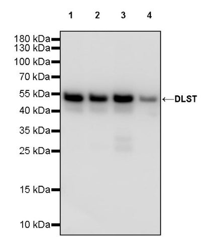 DLST Recombinant Rabbit mAb (S-2283-10)
