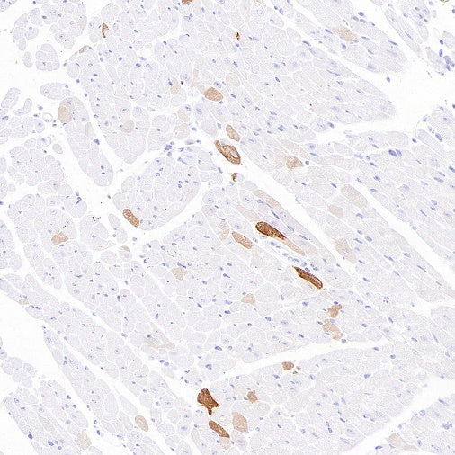 MYH7 Recombinant Rabbit mAb ,PBS Only (SDT-2936-44)